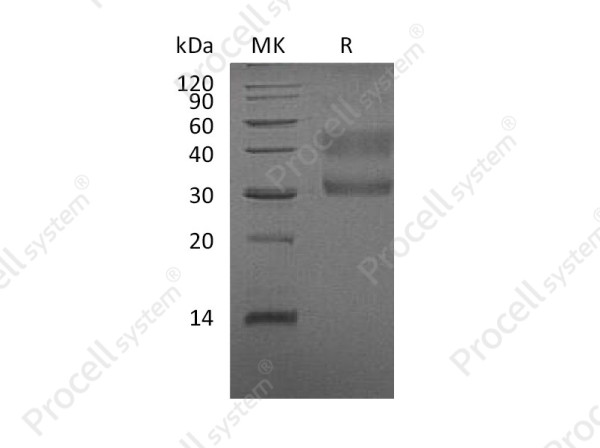 HGF R/c-Met/HGFR (Glu25-Gly519), Human, Recombinant