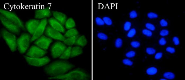 Anti-Cytokeratin 7, clone SQab1888