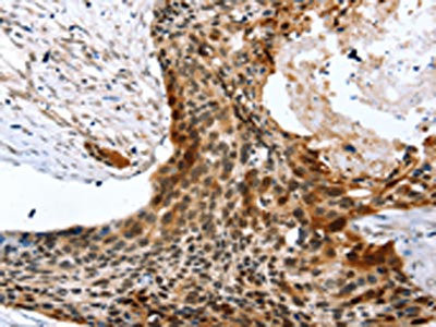 Anti-SYNPO2