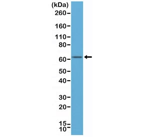 Anti-Estrogen Receptor alpha / N-Terminal Region (recombinant antibody), clone RM292