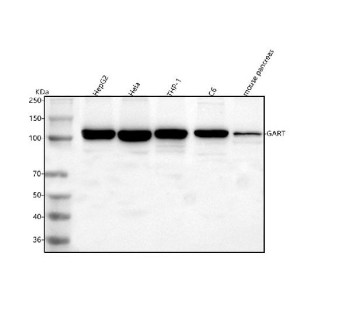Anti-GART / Phosphoribosylglycinamide formyltransferase