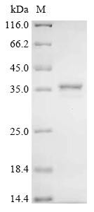 Tumor necrosis factor receptor superfamily member EDAR (EDAR), recombinant human
