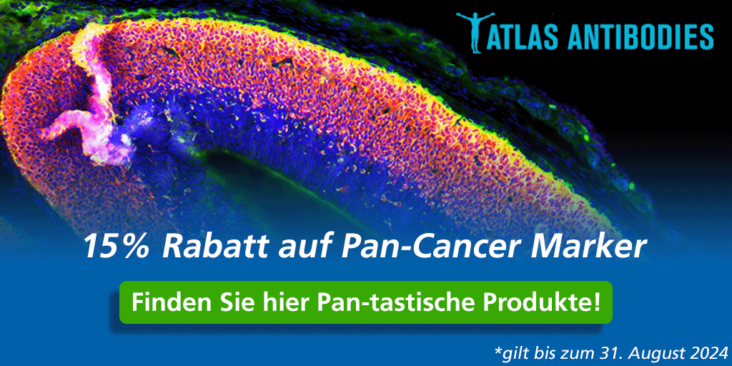 Atlas Antibodies Pan-Cancer Marker