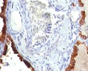 Anti-Cytokeratin 7, clone KRT7/760