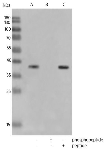 Anti-Phospho-CrkL (Tyr207) Monoclonal Recombinant Antibody