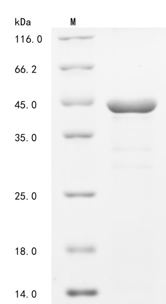 Syntenin-1 (SDCBP), human, recombinant