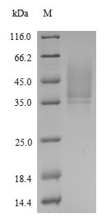 Probetacellulin (BTC), human, recombinant