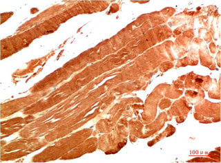 Anti-NBR1 Monoclonal