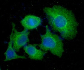 Anti-Thymidylate Synthase, clone 21S5