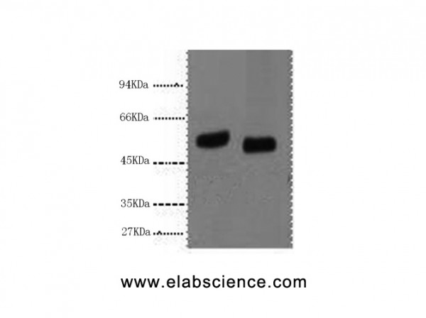 Anti-P53, clone 1H4