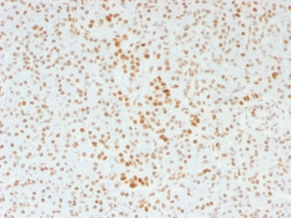 Anti-ATRX / RAD54 (Alpha Thalassemia Mental Retardation), clone 39f
