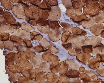 Anti-Carbonic Anhydrase 3 / CA3, clone CA3/7885