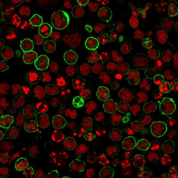 Anti-CD20 / Membrane spanning 4-domains A1, clone L26 + IGEL/773