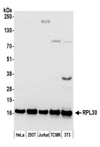 Anti-RPL30/Ribosomal Protein L30