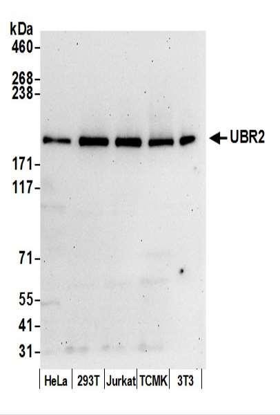 Anti-UBR2