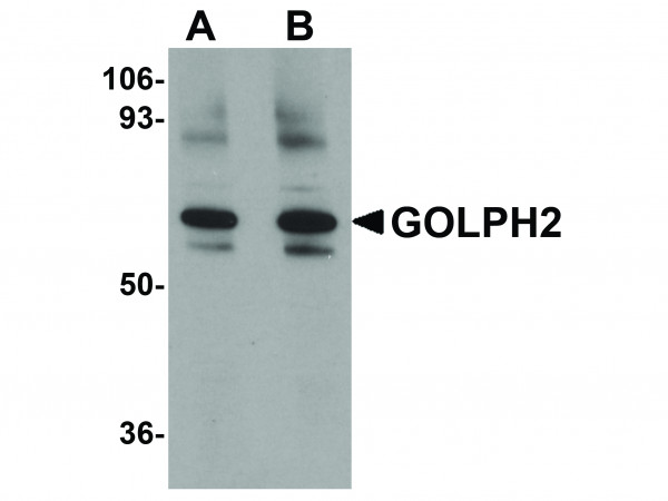 Anti-GOLPH2