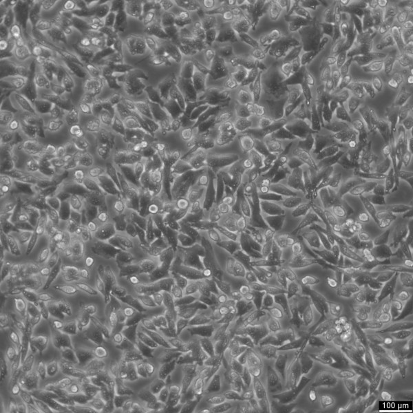 UM-UC-3 Cells