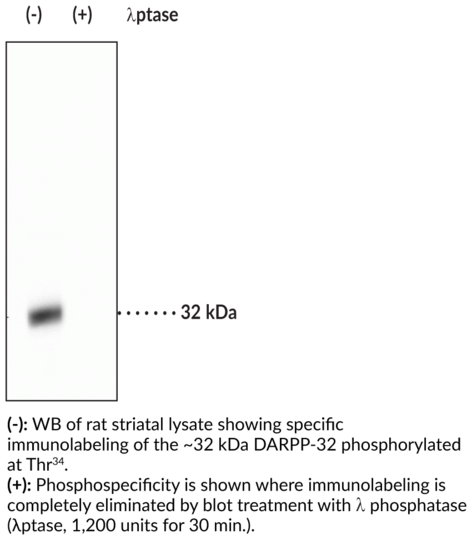 Anti-DARPP-32 (Phospho-Thr34)