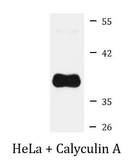 Anti-phospho-PPP1A (Thr320)