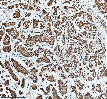 Anti-DIS3 / Exosome complex exonuclease RRP44
