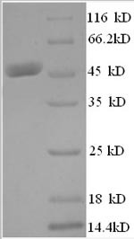 Histone acetyltransferase KAT7 (KAT7), partial, human, recombinant