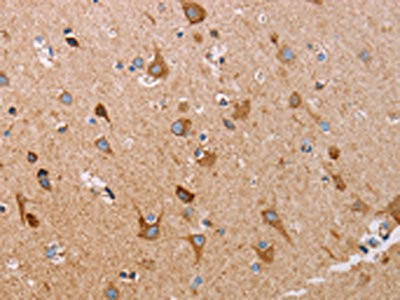 Anti-ATP5J