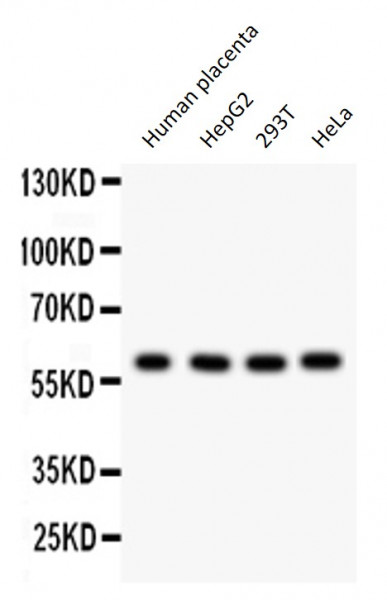Anti-CDC73 / Parafibromin