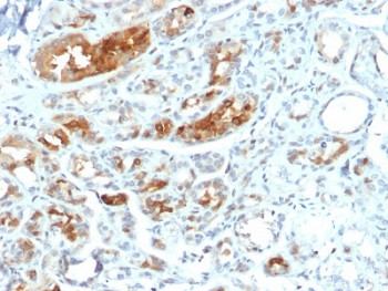 Anti-Mammaglobin A / SCGB2A2, clone MGB/2000
