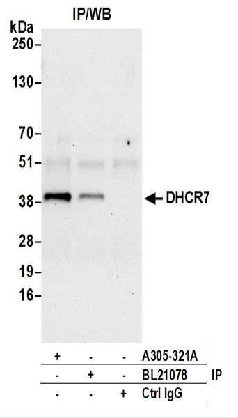 Anti-DHCR7