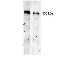 Anti-Thyroglobulin (Tg), clone 2H11