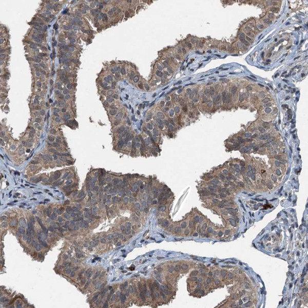Anti-TCTN1