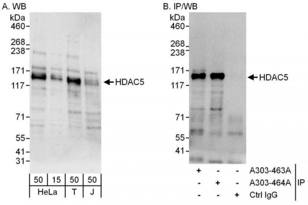 Anti-HDAC5