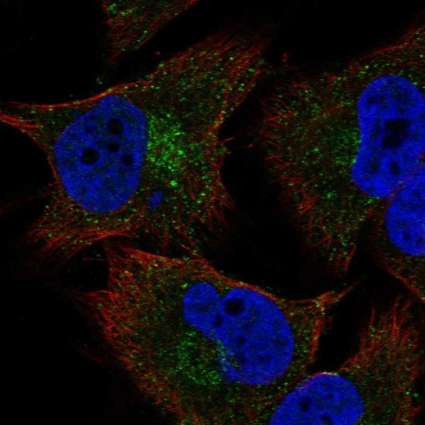 Anti-COL20A1