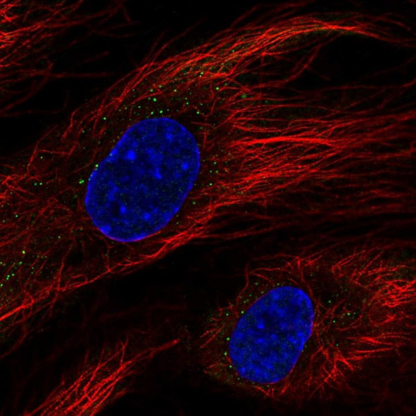 Anti-BCL6B