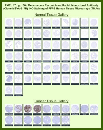 Anti-PMEL17 / Melanoma gp100, clone MSVA-617R