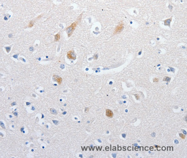 Anti-MATN1