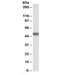 Anti-Cytokeratin 20