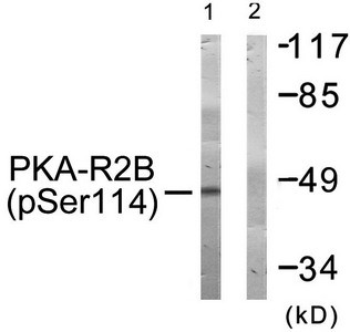 Anti-Phospho-PRKAR2B (Ser113)