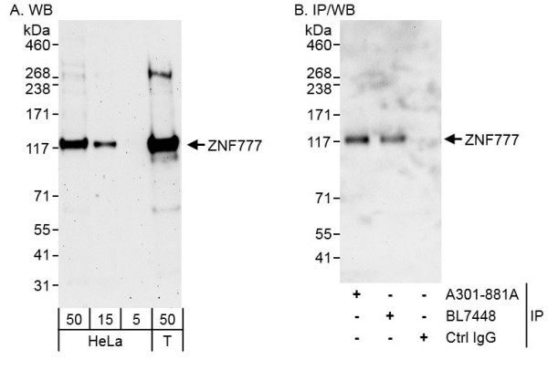 Anti-ZNF777
