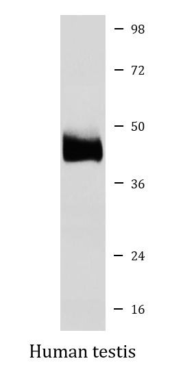 Anti-ORM1 / alpha 1 Acid Glycoprotein
