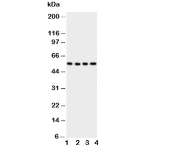 Anti-GLUT5 (Glucose Transporter 5)