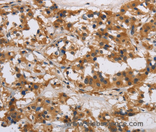 Anti-IL17RB