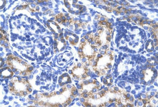 Anti-CREB3L2 / BBF2H7