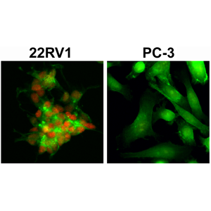 Anti-AR (ARv7 Splice Variant) (human), Rabbit Monoclonal (RM7)