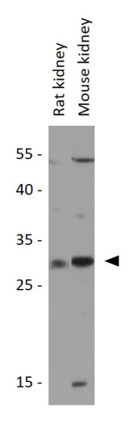 Anti-STC1 / Stanniocalcin 1