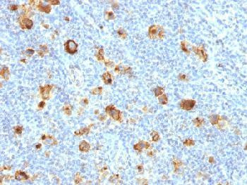 Anti-CD15 / FUT4 (Reed-Sternberg Cell Marker) (clone: FUT4/1478R) (recombinant rabbit monoclonal)