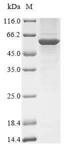 Serine/threonine-protein phosphatase 2A 55 kDa regulatory subunit B gamma isoform (PPP2R2C), human,