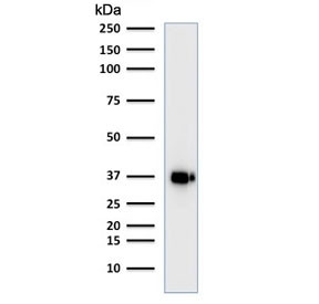 Anti-POU2AF1 / BOB-1, clone BOB1/2421