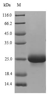 ATP-sensitive inward rectifier potassium channel 1 (KCNJ1), partial, human, recombinant