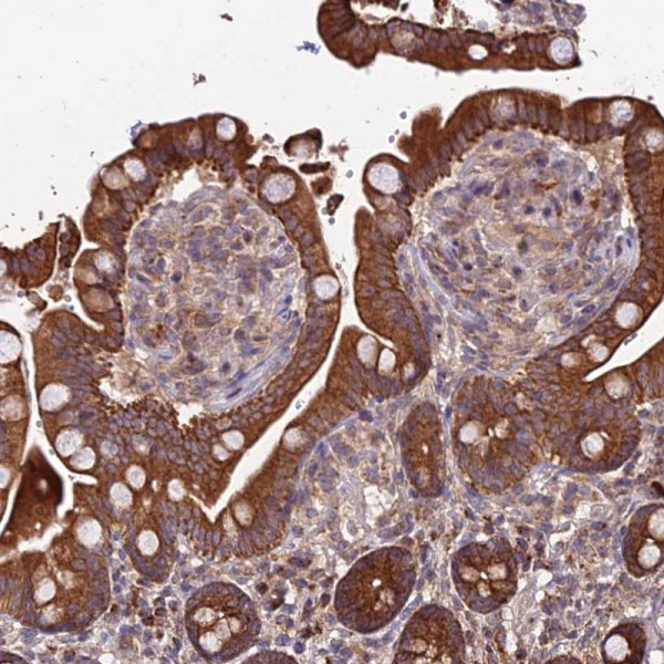 Anti-PEX19